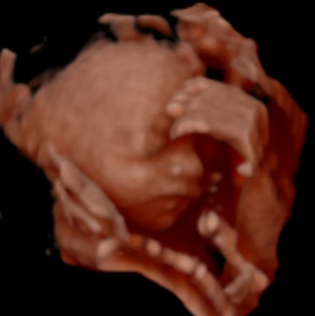 Ultrason Görüntüsü 5