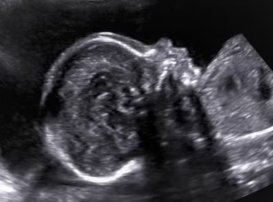 4 Boyutlu Ayrıntılı Gebelik Ultrasonu (Anomali Taraması) görsel 1